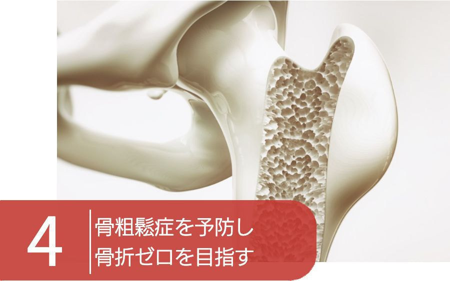 大阪市　骨粗鬆症